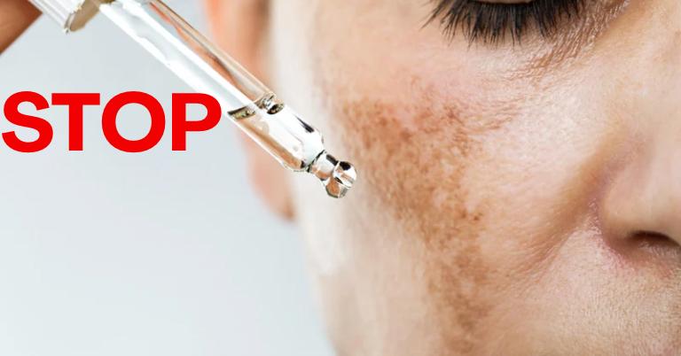 Stop Hyperpigmentation